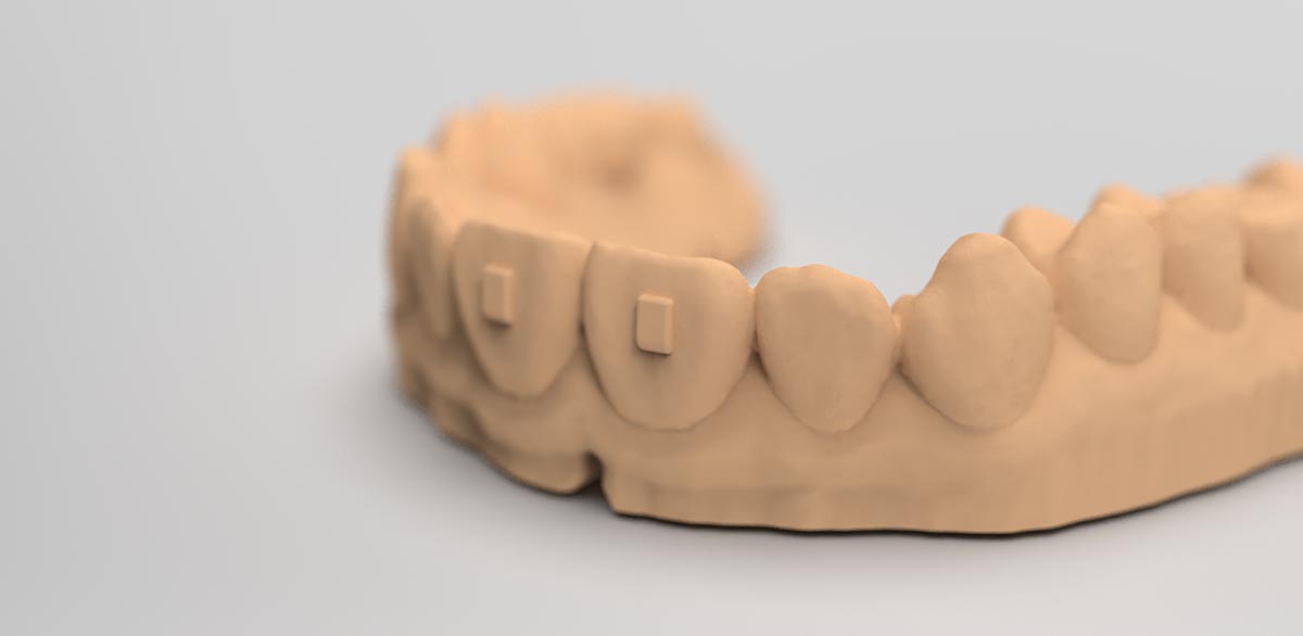 dental_model1
