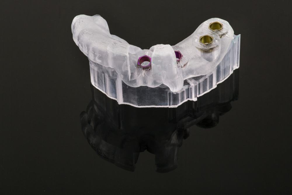Oral surgical guide future of 3D printing in dentistry