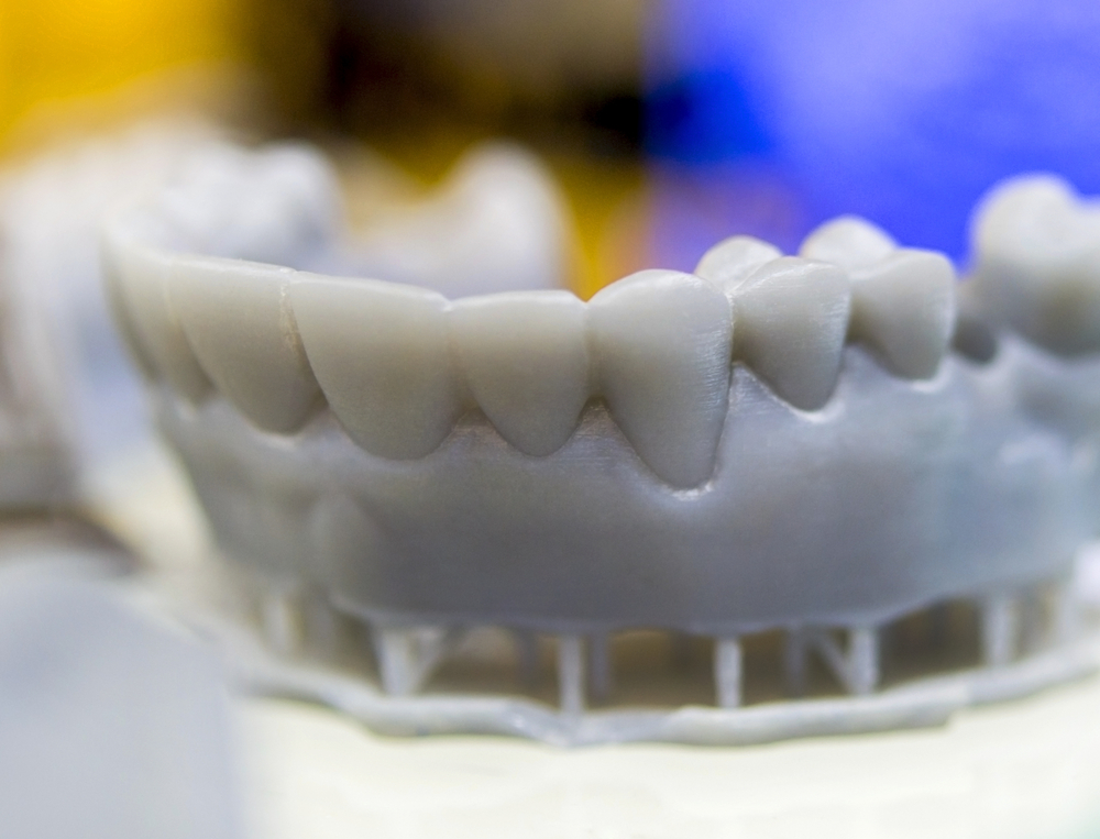 3D printed dental model