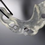 3D printed dental surgical guide