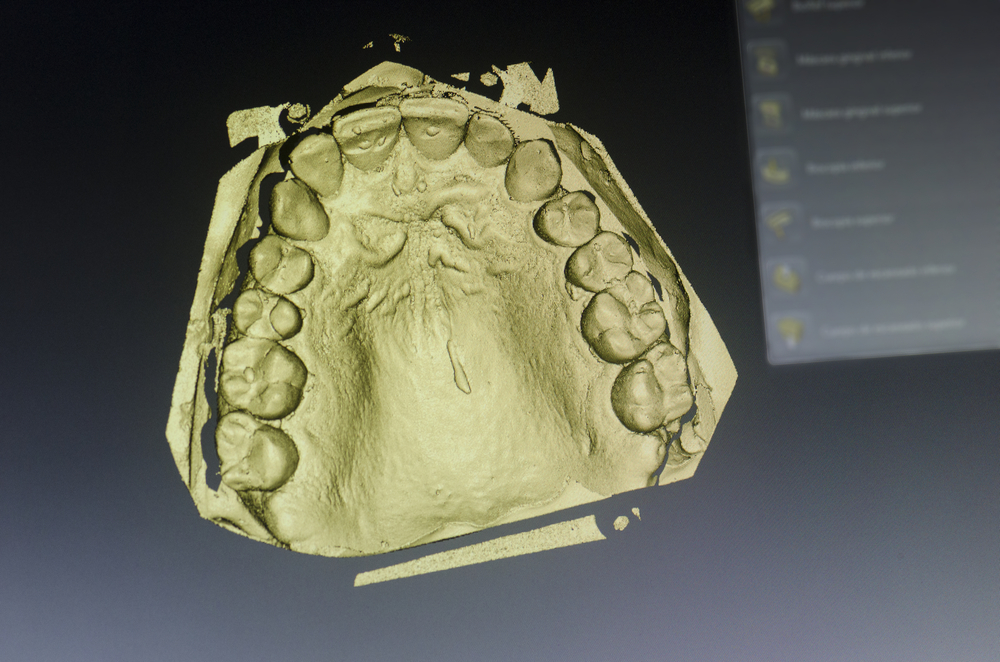 3D-printed dental study model