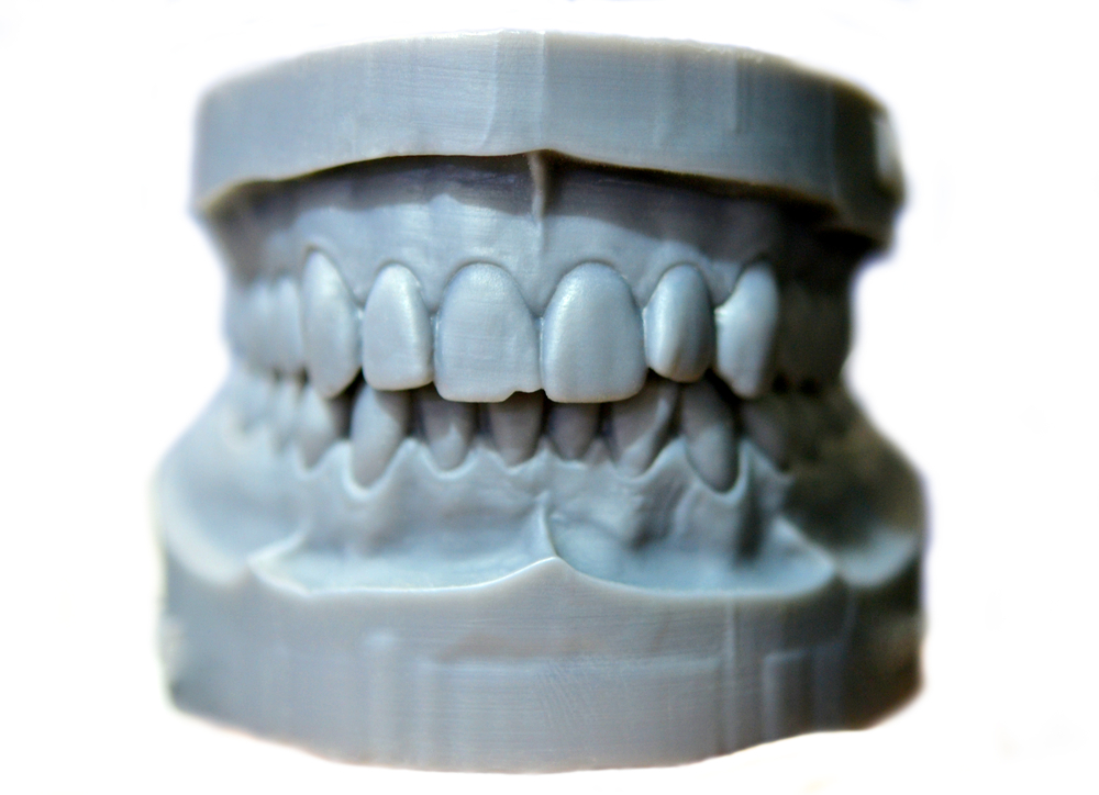 3D printed dental study model.