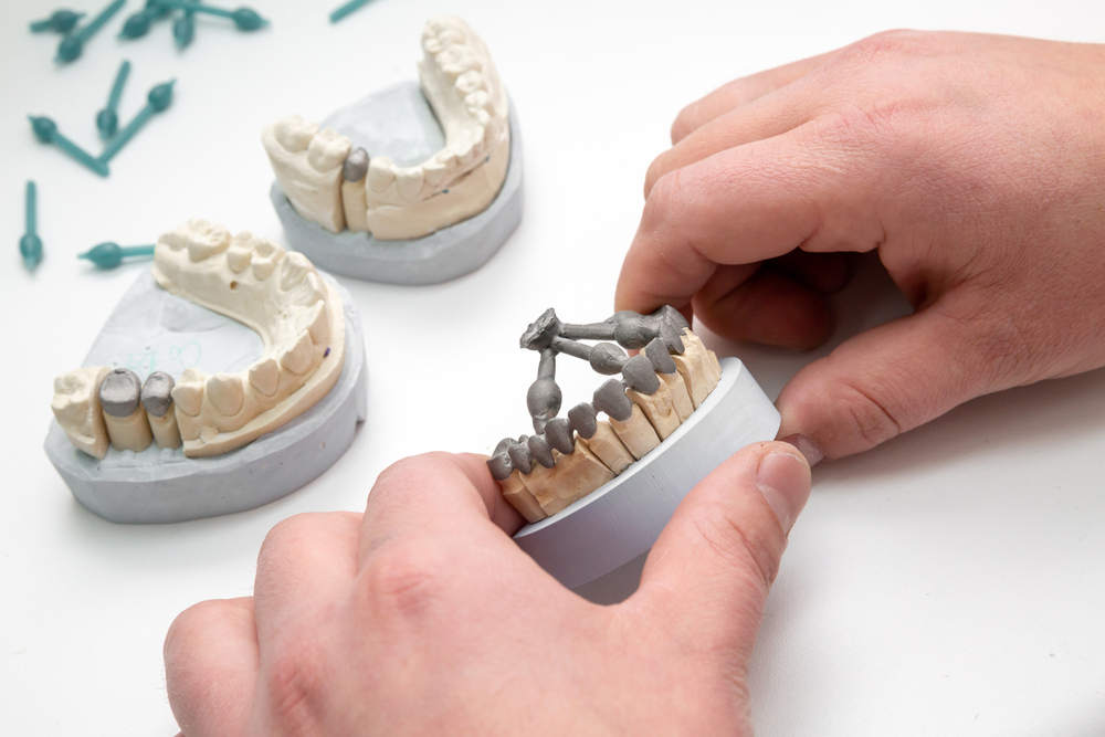 3D printing dental applications dentures
