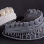 3D-printed dental model