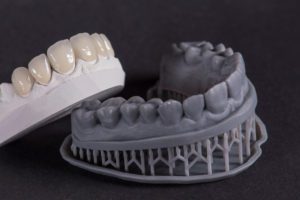 3D-printed dental model
