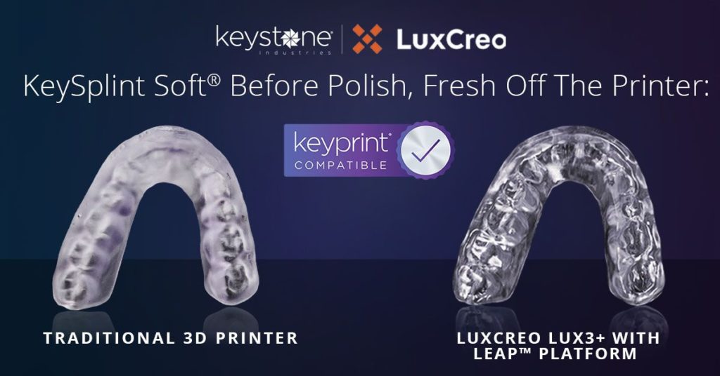 Dental_Splints_with_LuxCreo_Digital_Polishing_vs_Competition