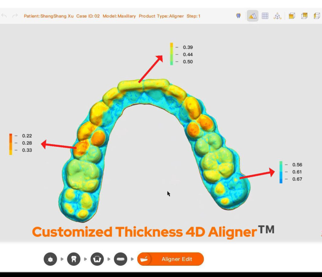Webinar: 4D Aligner Clinical Study Progress Update - LuxCreo