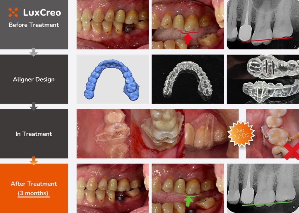 Clinical Case Examples