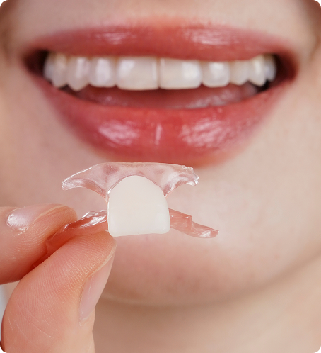 Deliver a New Standard of Flexible Partial Dentures