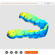 Treatment Planning and 4D Aligner Design