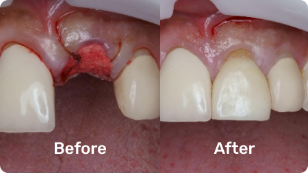 Real Clinical Results