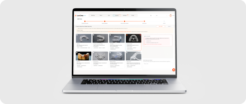 Seamless Design via LuxCloud Dental Workflow