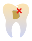 Less or No Attachments